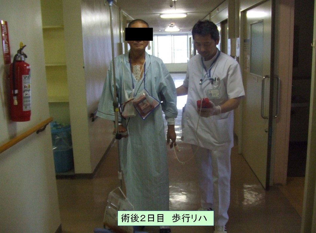 術後2日目歩行リハ